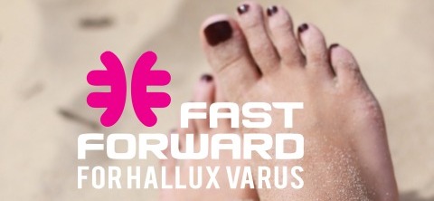 FastForward for Hallux Varus