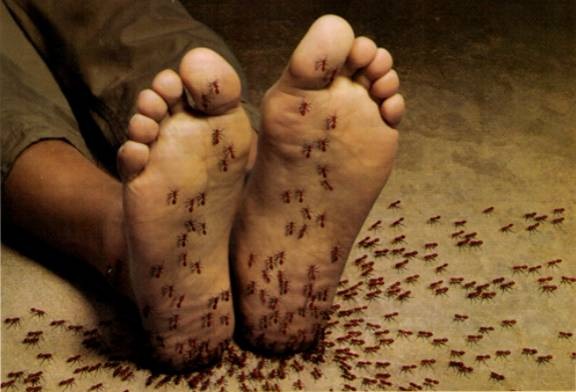 Peripheral Neuropathy